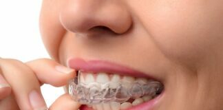 Getting Started with Adult Orthodontia Adult Orthodontia