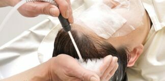 Types of Scalp Treatment Scalp Treatment