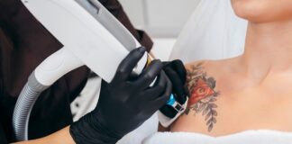 Factors that Affect the Cost of Tattoo Removal Tattoo Removal
