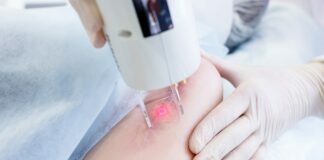 Which Scar Treatment Should You Choose? Scar Treatment