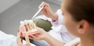 What Do You Know About The Benefits Of Dental Implants? Dental Implants
