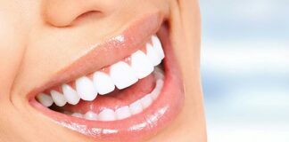 Teeth Whitening: The Best Solution to Achieve a Shiny Smile Teeth Whitening