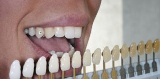 Essential Facts about Teeth Whitening Teeth Whitening