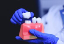 Five Mistruths About Oral Implants You May See Online Oral Implants